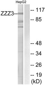 ZZZ3 Antibody in Western Blot (WB)