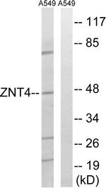 SLC30A4 Antibody in Western Blot (WB)