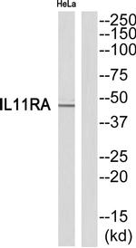 IL11RA Antibody in Western Blot (WB)