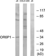 OR6P1 Antibody in Western Blot (WB)