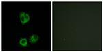 Phospho-LCK (Tyr394) Antibody in Immunocytochemistry (ICC/IF)