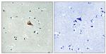 Phospho-TrkA (Tyr701) Antibody in Immunohistochemistry (Paraffin) (IHC (P))