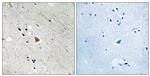 Phospho-FLT3 (Tyr969) Antibody in Immunohistochemistry (Paraffin) (IHC (P))