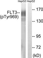 Phospho-FLT3 (Tyr969) Antibody in Western Blot (WB)