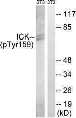 Phospho-ICK (Tyr159) Antibody in Western Blot (WB)