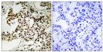 Phospho-PKR (Thr258) Antibody in Immunohistochemistry (Paraffin) (IHC (P))