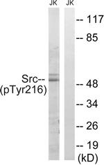 Phospho-SRC (Tyr216) Antibody in Western Blot (WB)