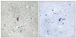 Phospho-APC1 (Ser355) Antibody in Immunohistochemistry (Paraffin) (IHC (P))