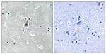 Phospho-Bax (Ser184) Antibody in Immunohistochemistry (Paraffin) (IHC (P))