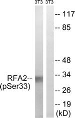 Phospho-RPA2 (Ser33) Antibody in Western Blot (WB)