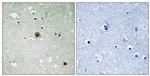 Phospho-TOP2A (Ser1525) Antibody in Immunohistochemistry (Paraffin) (IHC (P))