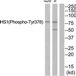 Phospho-HCLS1 (Tyr378) Antibody in Western Blot (WB)