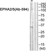 EphA2/EphA5 Antibody in Western Blot (WB)