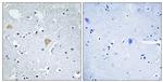 CIT Antibody in Immunohistochemistry (Paraffin) (IHC (P))