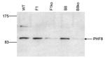 PHF8 Antibody in Western Blot (WB)