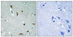 Phospho-AKT1/AKT3 (Tyr437, Tyr434) Antibody in Immunohistochemistry (Paraffin) (IHC (P))