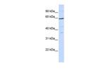 TCF7L1 Antibody in Western Blot (WB)