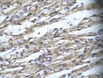 RBM10 Antibody in Immunohistochemistry (Paraffin) (IHC (P))