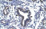 RBM10 Antibody in Immunohistochemistry (Paraffin) (IHC (P))