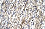 RBM10 Antibody in Immunohistochemistry (Paraffin) (IHC (P))