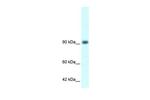 RBM10 Antibody in Western Blot (WB)