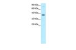 KIN Antibody in Western Blot (WB)