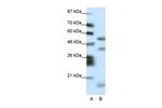 LIM1 Antibody in Western Blot (WB)