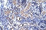 TAF1 Antibody in Immunohistochemistry (IHC)