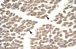 PLA1 Antibody in Immunohistochemistry (IHC)