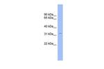 CNOT7 Antibody in Western Blot (WB)