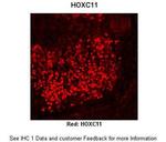 HOXC11 Antibody in Immunohistochemistry (IHC)