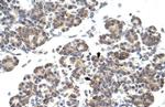 HES6 Antibody in Immunohistochemistry (IHC)