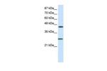 HES6 Antibody in Western Blot (WB)