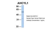 AdoHcyase 2 Antibody in Western Blot (WB)