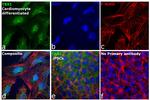 TBX1 Antibody in Immunocytochemistry (ICC/IF)