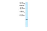 APOBEC3G Antibody in Western Blot (WB)