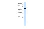 FXR Antibody in Western Blot (WB)