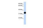 MED27 Antibody in Western Blot (WB)