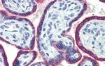 ASH2L Antibody in Immunohistochemistry (IHC)