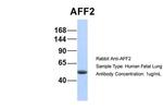 AFF2 Antibody in Western Blot (WB)