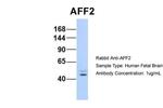 AFF2 Antibody in Western Blot (WB)