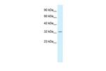 PAX9 Antibody in Western Blot (WB)