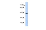 KCNK1 Antibody in Western Blot (WB)