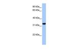 CACNG4 Antibody in Western Blot (WB)