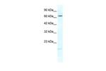 KCNH6 Antibody in Western Blot (WB)