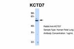 KCTD7 Antibody in Western Blot (WB)