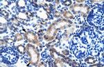 ONECUT2 Antibody in Immunohistochemistry (IHC)