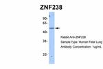 ZNF238 Antibody in Western Blot (WB)