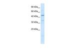 ZNF358 Antibody in Western Blot (WB)