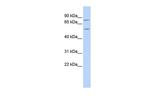 ZNF333 Antibody in Western Blot (WB)